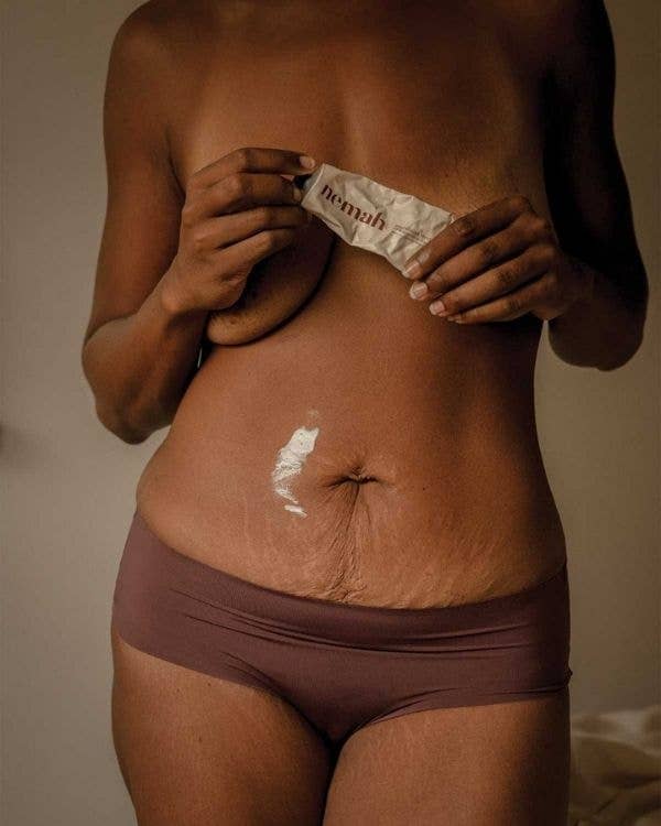Revitalizing Stretch Mark Cream